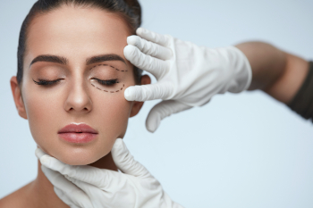 blefaroplastyka